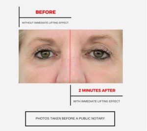 IMMEDIATE LIFTING EFFECT